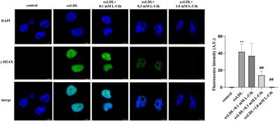 L-cystathionine protects against oxidative stress and DNA damage induced by oxidized low-density lipoprotein in THP-1-derived macrophages